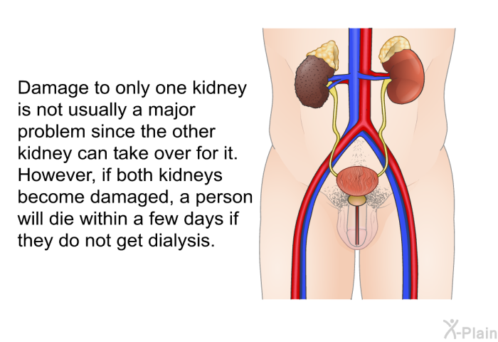 Damage to only one kidney is not usually a major problem since the other kidney can take over for it. However, if both kidneys become damaged, a person will die within a few days if they do not get dialysis.