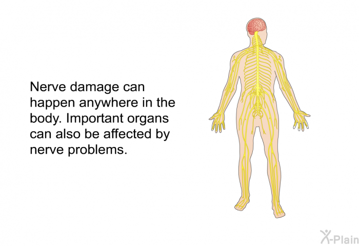 Nerve damage can happen anywhere in the body. Important organs can also be affected by nerve problems.