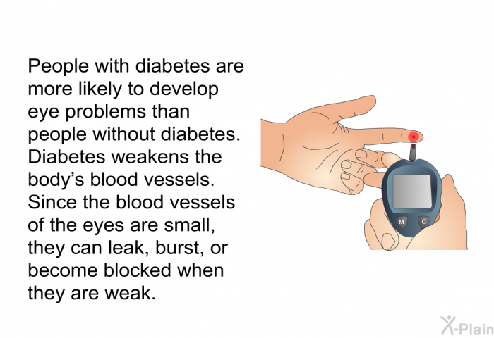 People with diabetes are more likely to develop eye problems than people without diabetes. Diabetes weakens the body's blood vessels. Since the blood vessels of the eyes are small, they can leak, burst, or become blocked when they are weak.