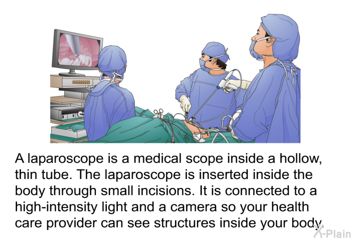 A laparoscope is a medical scope inside a hollow, thin tube. The laparoscope is inserted inside the body through small incisions. It is connected to a high-intensity light and a camera so your health care provider can see structures inside your body.
