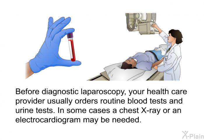 Before diagnostic laparoscopy, your health care provider usually orders routine blood tests and urine tests. In some cases a chest X-ray or an electrocardiogram may be needed.