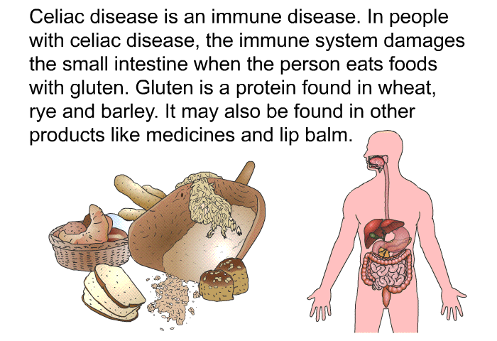 Celiac disease is an immune disease. In people with celiac disease, the immune system damages the small intestine when the person eats foods with gluten. Gluten is a protein found in wheat, rye and barley. It may also be found in other products like medicines and lip balm.