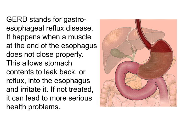 GERD stands for gastro-esophageal reflux disease. It happens when a muscle at the end of the esophagus does not close properly. This allows stomach contents to leak back, or reflux, into the esophagus and irritate it. If not treated, it can lead to more serious health problems.