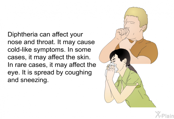 Diphtheria can affect your nose and throat. It may cause cold-like symptoms. In some cases, it may affect the skin. In rare cases, it may affect the eye. It is spread by coughing and sneezing.