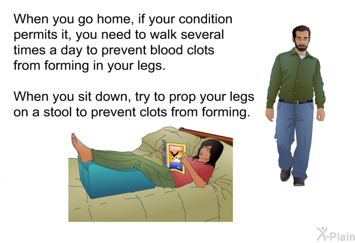 When you go home, if your condition permits it, you need to walk several times a day to prevent blood clots from forming in your legs. When you sit down, try to prop your legs on a stool to prevent clots from forming.