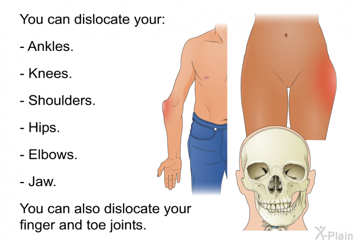 You can dislocate your:  Ankles. Knees. Shoulders. Hips. Elbows. Jaw.  
 You can also dislocate your finger and toe joints.