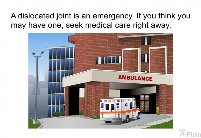A dislocated joint is an emergency. If you think you may have one, seek medical care right away.