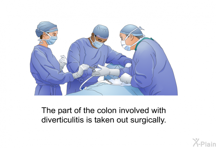 The part of the colon involved with diverticulitis is taken out surgically.