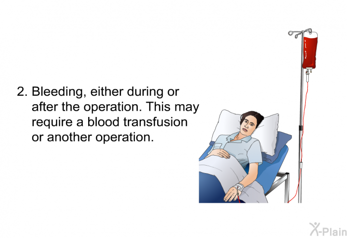 Bleeding, either during or after the operation. This may require a blood transfusion or another operation.