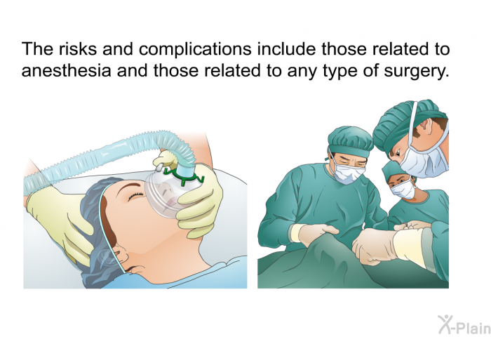 The risks and complications include those related to anesthesia and those related to any type of surgery.