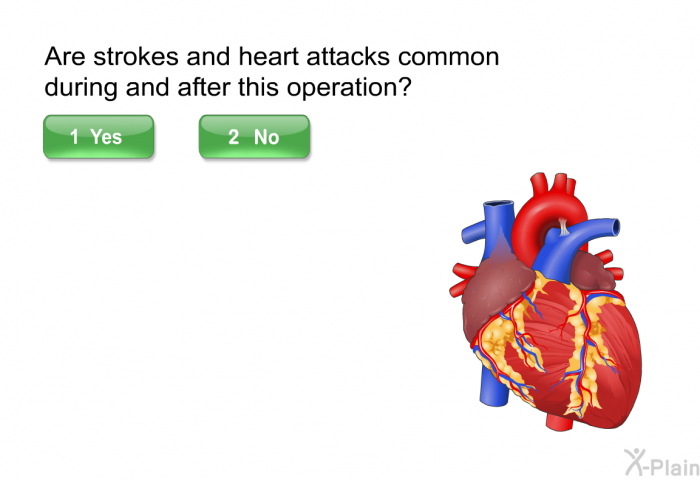Are strokes and heart attacks common during and after this operation?