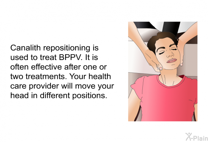 Canalith repositioning is used to treat BPPV. It is often effective after one or two treatments. Your health care provider will move your head in different positions.