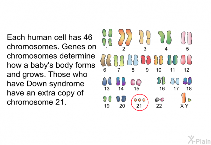 Each human cell has 46 chromosomes. Genes on chromosomes determine how a baby's body forms and grows. Those who have Down syndrome have an extra copy of chromosome 21.