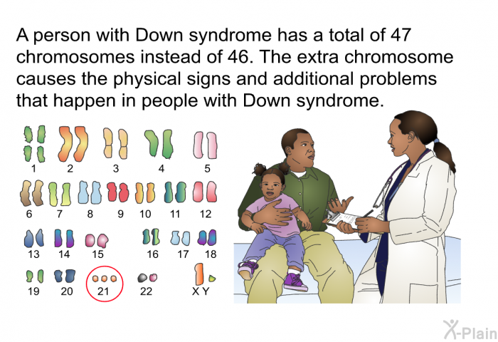 A person with Down syndrome has a total of 47 chromosomes instead of 46. The extra chromosome causes the physical signs and additional problems that happen in people with Down syndrome.