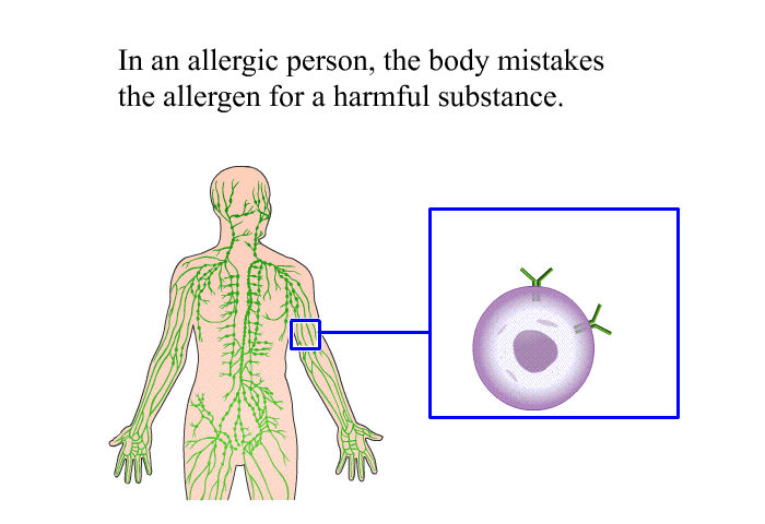 In an allergic person, the body mistakes the allergen for a harmful substance.
