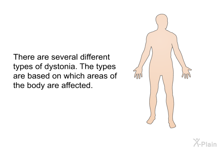 There are several different types of dystonia. The types are based on which areas of the body are affected.