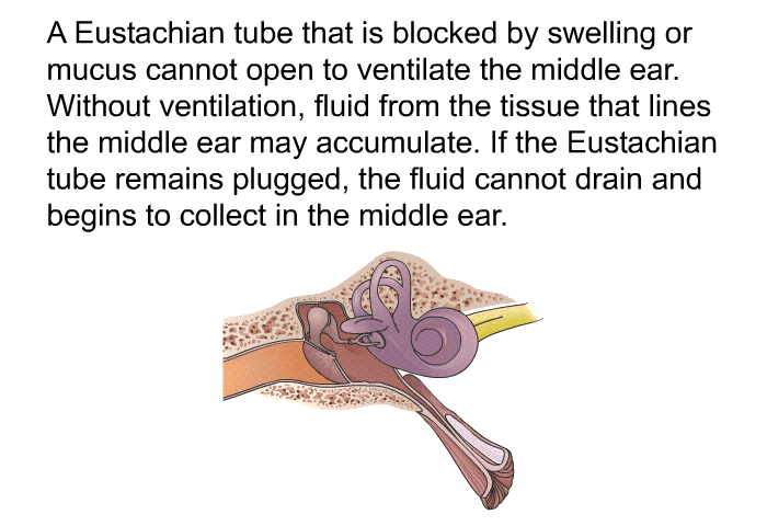 A Eustachian tube that is blocked by swelling or mucus cannot open to ventilate the middle ear. Without ventilation, fluid from the tissue that lines the middle ear may accumulate. If the Eustachian tube remains plugged, the fluid cannot drain and begins to collect in the middle ear.