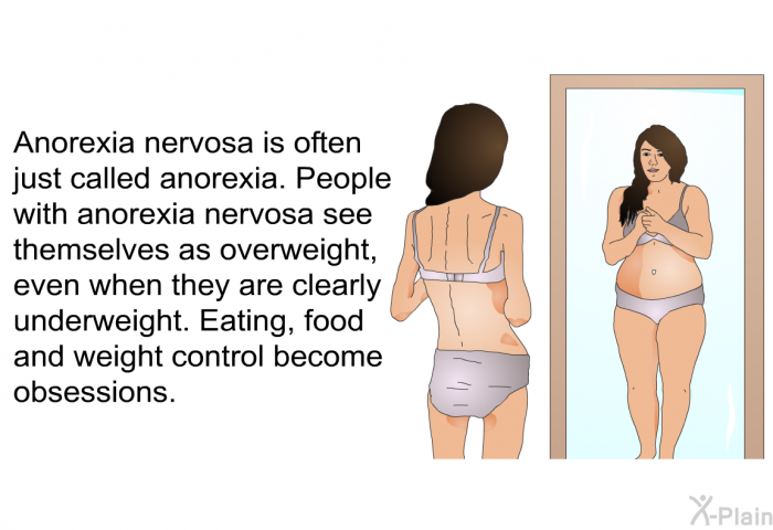 Anorexia nervosa is often just called anorexia. People with anorexia nervosa see themselves as overweight, even when they are clearly underweight. Eating, food and weight control become obsessions.