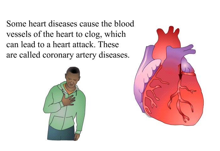 Some heart diseases cause the blood vessels of the heart to clog, which can lead to a heart attack. These are called coronary artery diseases.
