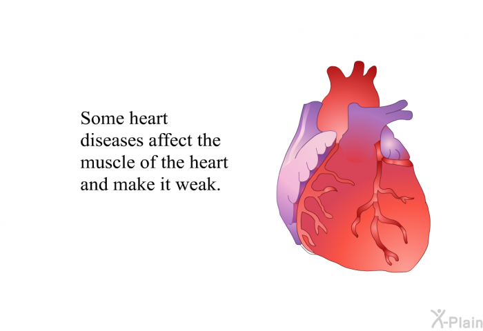 Some heart diseases affect the muscle of the heart and make it weak.