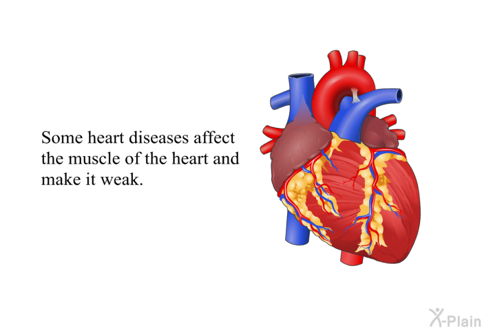 Some heart diseases affect the muscle of the heart and make it weak.