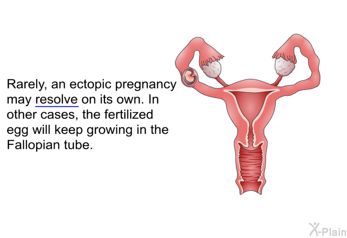 Rarely, an ectopic pregnancy may resolve on its own. In other cases, the fertilized egg will keep growing in the Fallopian tube.