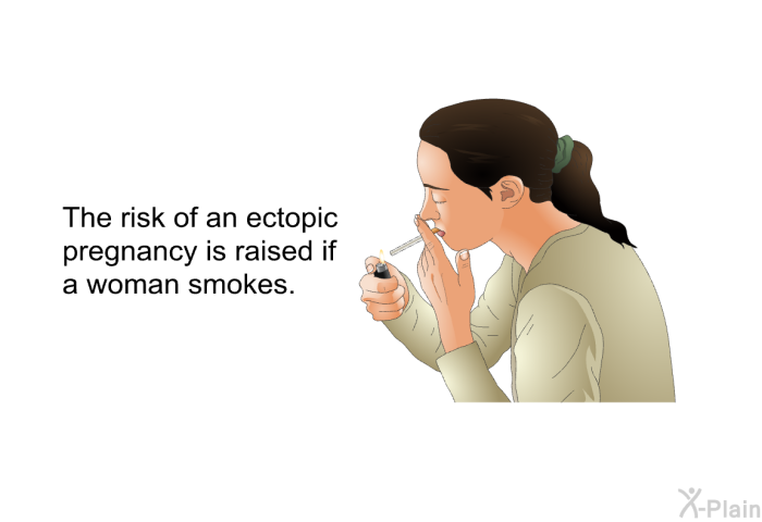 The risk of an ectopic pregnancy is raised if a woman smokes.