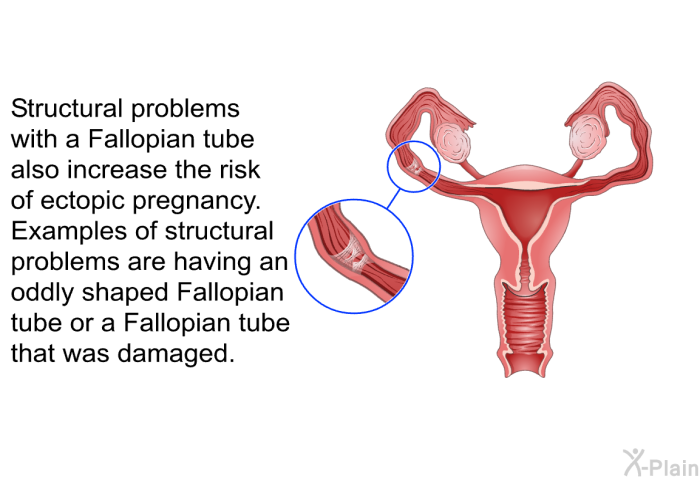 Structural problems with a Fallopian tube also increase the risk of ectopic pregnancy. Examples of structural problems are having an oddly shaped Fallopian tube or a Fallopian tube that was damaged.