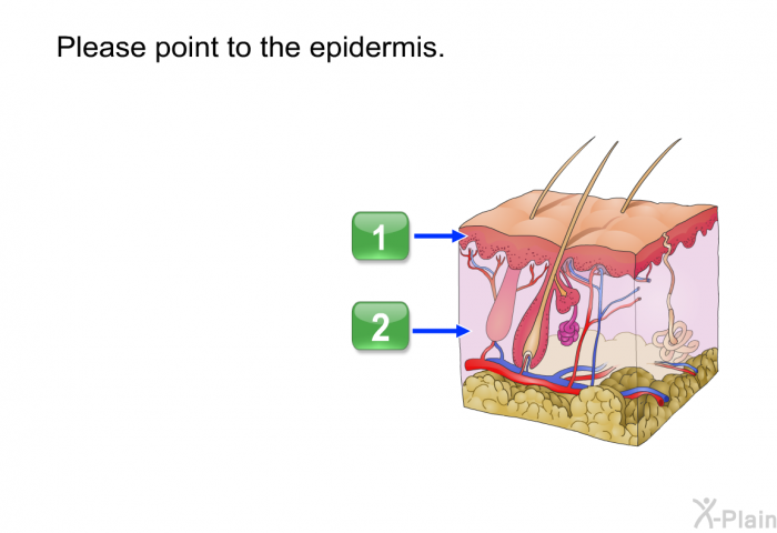 Please point to the epidermis.