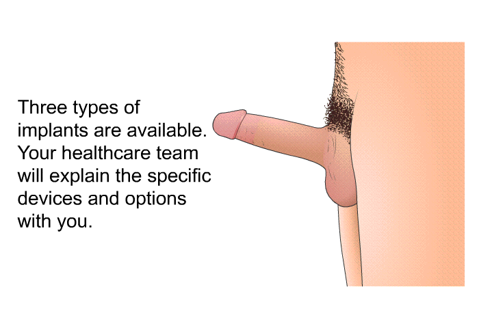 Three types of implants are available. Your healthcare team will explain the specific devices and options with you.