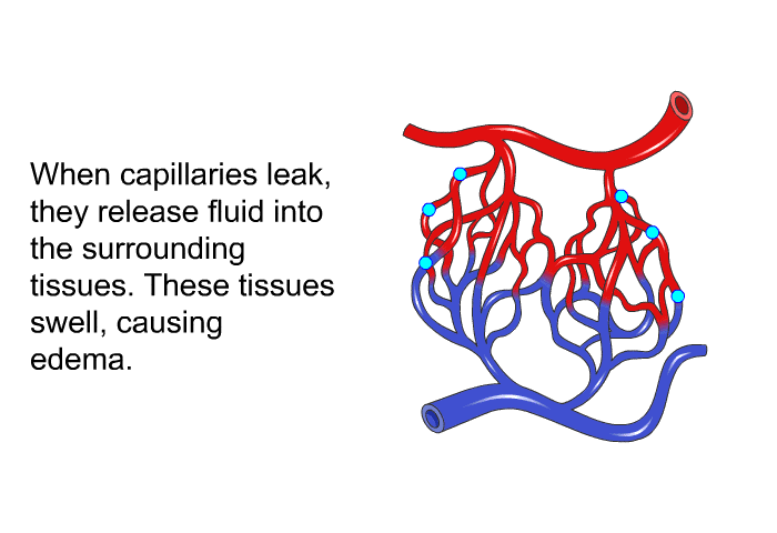When capillaries leak, they release fluid into the surrounding tissues. These tissues swell, causing edema.