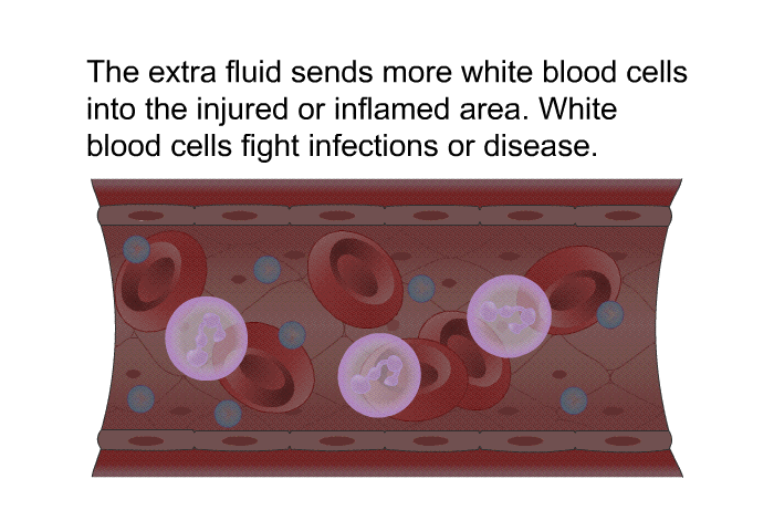The extra fluid sends more white blood cells into the injured or inflamed area. White blood cells fight infections or disease.