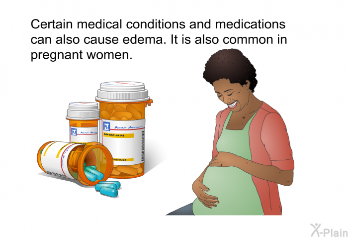 Certain medical conditions and medications can also cause edema. It is also common in pregnant women.