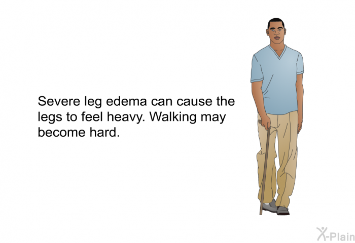 Severe leg edema can cause the legs to feel heavy. Walking may become hard.