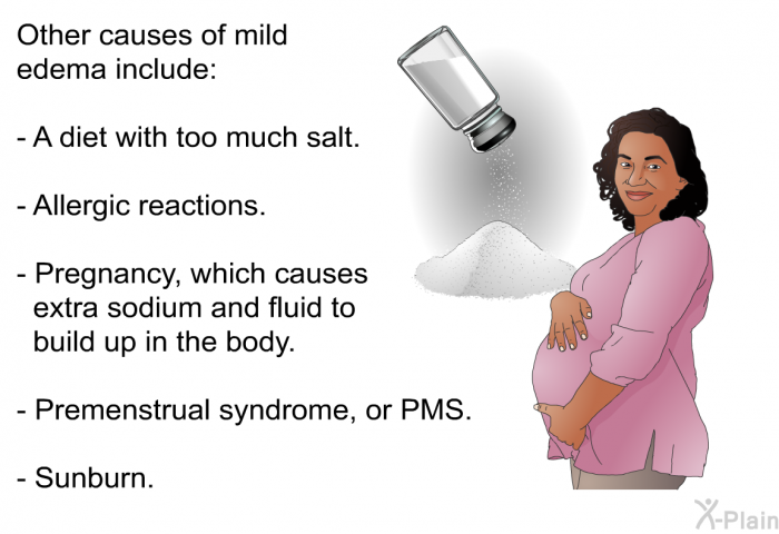 Other causes of mild edema include:  A diet with too much salt. Allergic reactions. Pregnancy, which causes extra sodium and fluid to build up in the body. Premenstrual syndrome, or PMS. Sunburn.