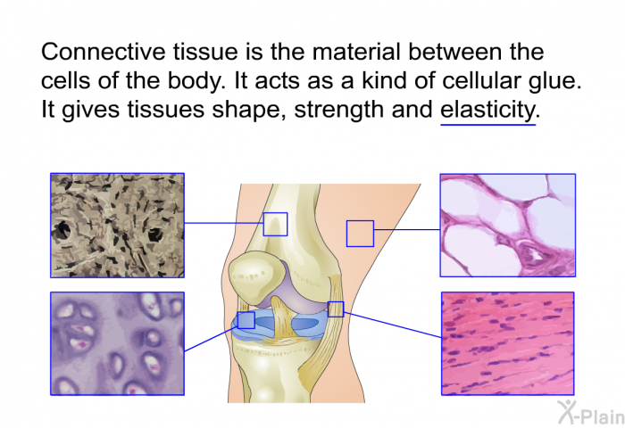 Connective tissue is the material between the cells of the body. It acts as a kind of cellular glue. It gives tissues shape, strength and elasticity.