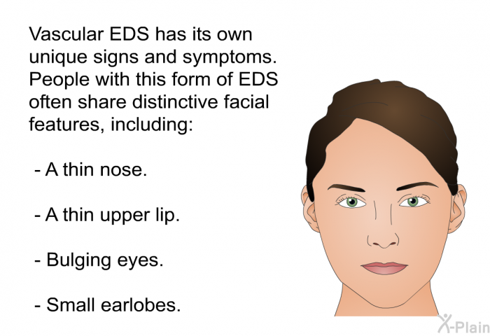 Vascular EDS has its own unique signs and symptoms. People with this form of EDS often share distinctive facial features, including:  A thin nose. A thin upper lip. Bulging eyes. Small earlobes.