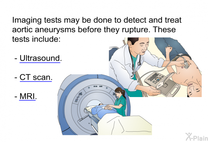 Imaging tests may be done to detect and treat aortic aneurysms before they rupture. These tests include:  Ultrasound. CT scan. MRI.