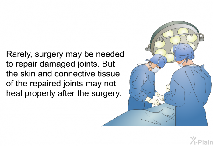 Rarely, surgery may be needed to repair damaged joints. But the skin and connective tissue of the repaired joints may not heal properly after the surgery.