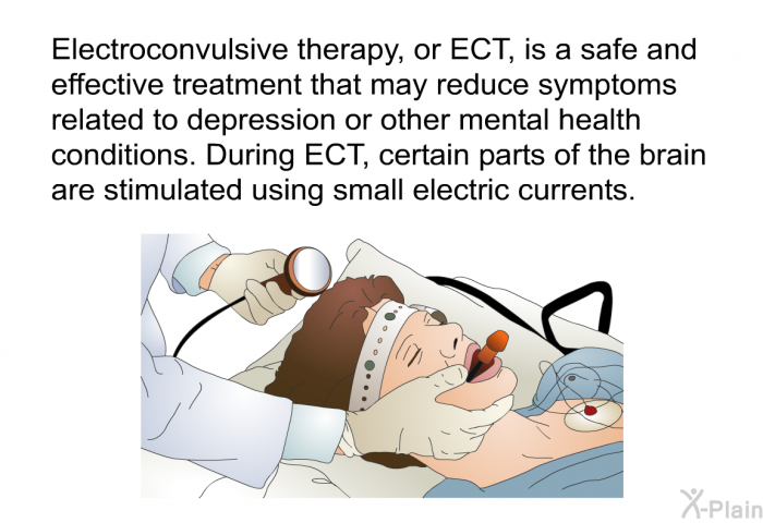 Electroconvulsive therapy, or ECT, is a safe and effective treatment that may reduce symptoms related to depression or other mental health conditions. During ECT, certain parts of the brain are stimulated using small electric currents.