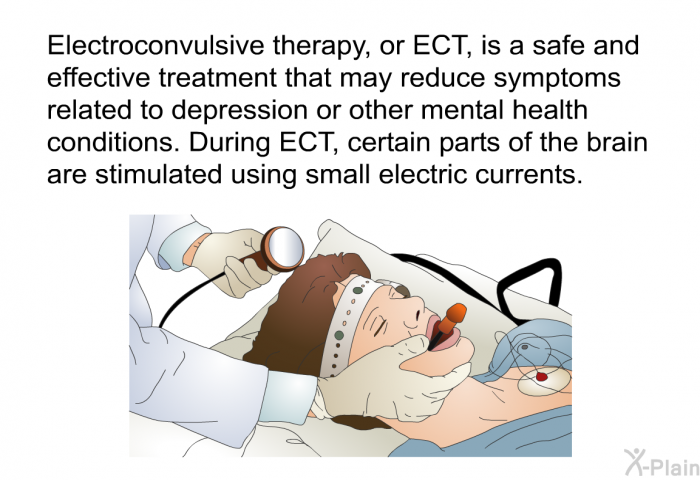 Electroconvulsive Therapy (ECT): Definition, Types, Techniques