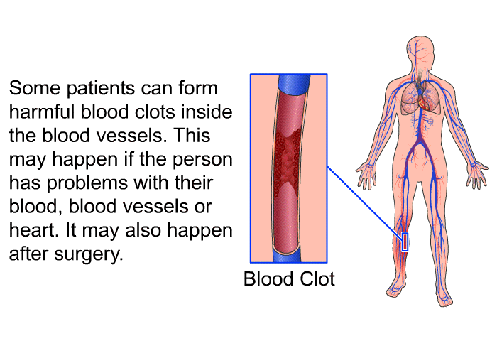 Some patients can form harmful blood clots inside the blood vessels. This may happen if the person has problems with their blood, blood vessels or heart. It may also happen after surgery.