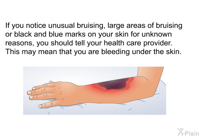 If you notice unusual bruising, large areas of bruising or black and blue marks on your skin for unknown reasons, you should tell your health care provider. This may mean that you are bleeding under the skin.