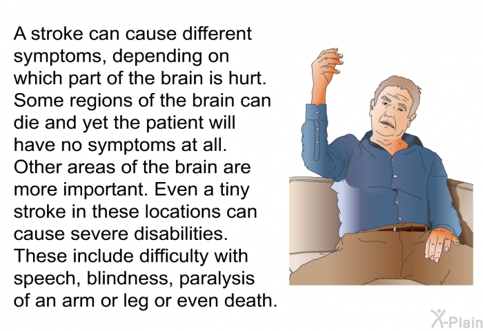 A stroke can cause different symptoms, depending on which part of the brain is hurt. Some regions of the brain can die and yet the patient will have no symptoms at all. Other areas of the brain are more important. Even a tiny stroke in these locations can cause severe disabilities. These include difficulty with speech, blindness, paralysis of an arm or leg or even death.