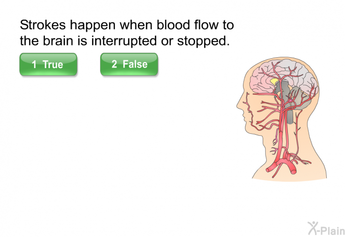 Strokes happen when blood flow to the brain is interrupted or stopped. Press true or false.