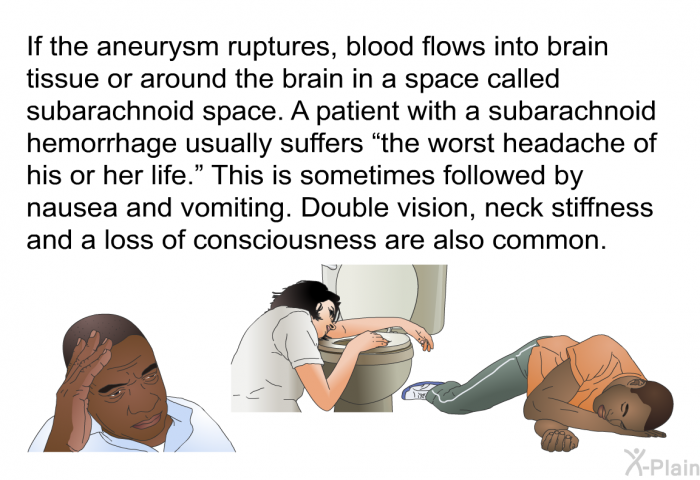 If the aneurysm ruptures, blood flows into brain tissue or around the brain in a space called subarachnoid space. A patient with a subarachnoid hemorrhage usually suffers “the worst headache of his or her life” This is sometimes followed by nausea and vomiting. Double vision, neck stiffness and a loss of consciousness are also common.