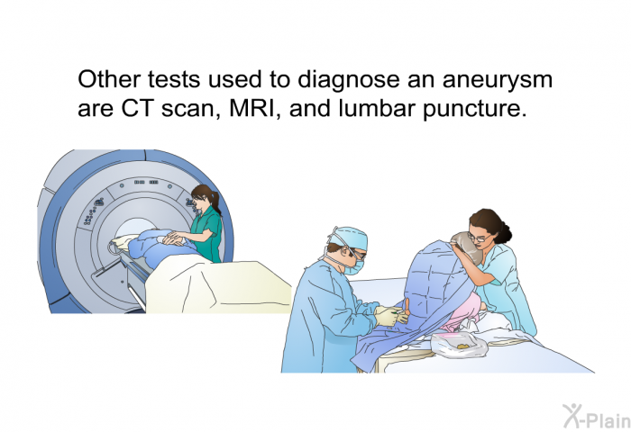 Other tests used to diagnose an aneurysm are CT scan, MRI, and lumbar puncture.