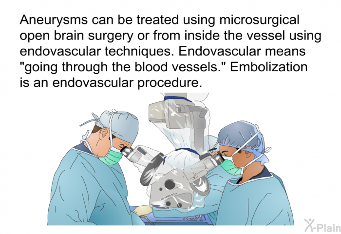 Aneurysms can be treated using microsurgical open brain surgery or from inside the vessel using endovascular techniques. Endovascular means “going through the blood vessels.” Embolization is an endovascular procedure.