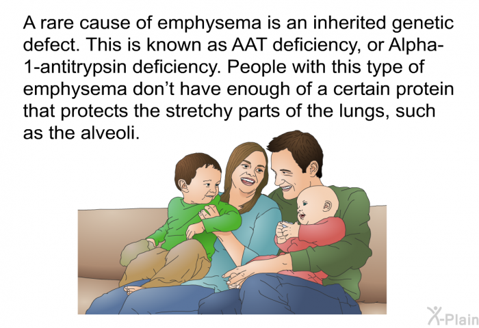 A rare cause of emphysema is an inherited genetic defect. This is known as AAT deficiency, or Alpha-1-antitrypsin deficiency. People with this type of emphysema don't have enough of a certain protein that protects the stretchy parts of the lungs, such as the alveoli.