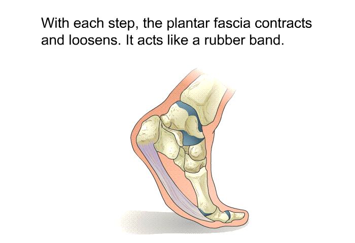 With each step, the plantar fascia contracts and loosens. It acts like a rubber band.